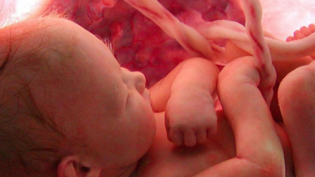 Diagnosi prenatale: i progressi della scienza - pavanellogroup.it