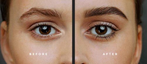 Mujer termina hospitalizada luego de realizarse un microblading