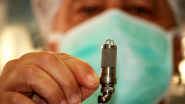 Mini-cuore artificiale salva la vita di una bambina | Bambino Ges&ugrave; ... - today.it