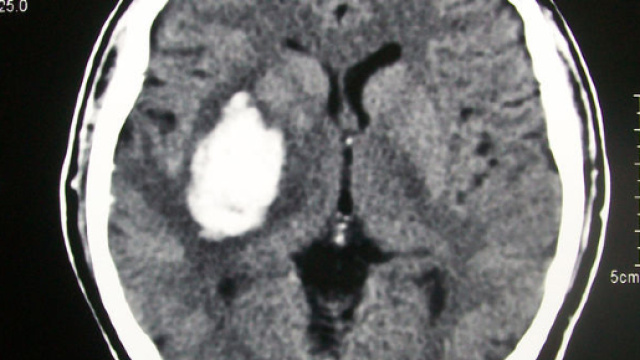 Tac con il telefono, ecco le cose da sapere	Ph. Wikimedia Commons - Bobjgalindo