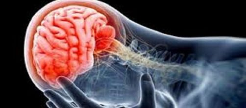 Conoce todas las posibles meningitis