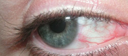 El s&iacute;ndrome de la vista cansada