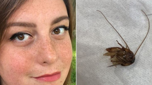 Ragazza vive per 9 giorni con uno scarafaggio nell'orecchio
