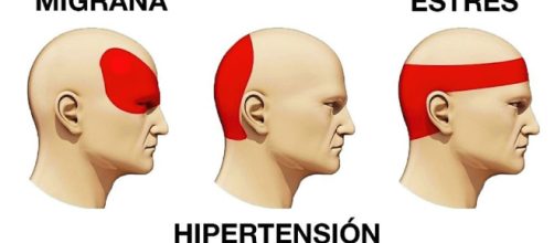 Descubre cu&aacute;les son los tipos de dolor de cabeza que existen, y cu&aacute;les son sus principales causas