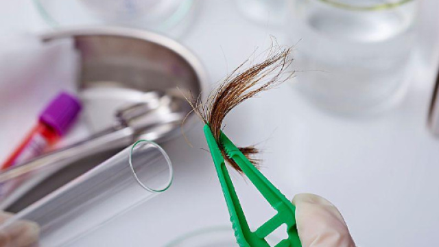 Calvizie: farmaco contro l'osteoporosi ferma la perdita dei capelli?