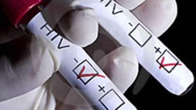 Ancona, positivo all'Hiv continuava a consumare rapporti 'intimi' non protetti.