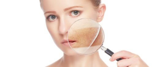 Informaci&oacute;n sobre las manchas en la piel