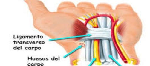 S&iacute;ndrome del t&uacute;nel carpiano, enfermedad ocupacional
