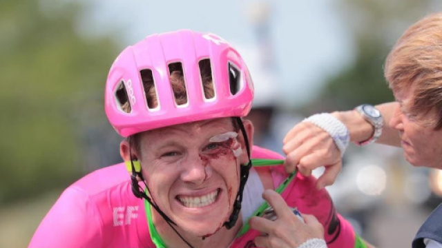 Craddock al Tour dopo la brutta caduta alla tappa 1 (foto twitter)