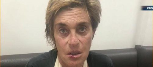 S&aacute;lvame: Chelo Garc&iacute;a Cort&eacute;s se parte el labio en una aparatosa ca&iacute;da