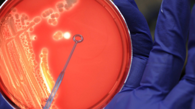 Superbatterio immune a molto trattamenti farmaceutici: si trasmette per via sessuale