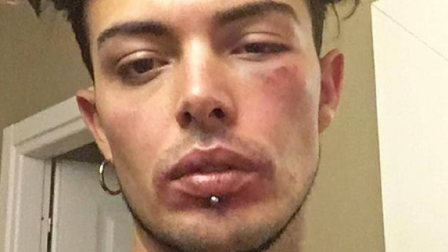 Stash dei The Kolors picchiato per avere difeso una ragazza