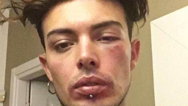 Stash dei The Kolors preso a cazzotti per difendere una donna | Si24 - si24.it