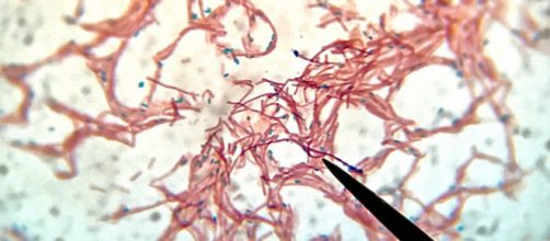 Bacterias terrestres que mutan en el espacio vuelven a la Tierra de manera m&aacute;s agresiva