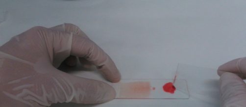 VENEZUELA / La malaria ha aumentado en el pa&iacute;s desde 2008 seg&uacute;n la OMS