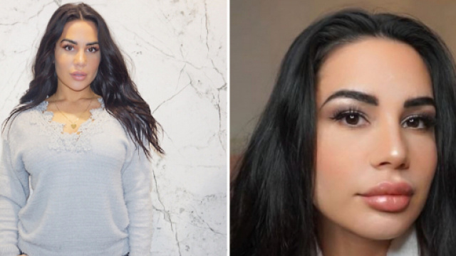 Milla Jasmine : ses l&egrave;vres jug&eacute;es &Eacute;NORMES, elle contre-attaque ! - gossip-room.fr