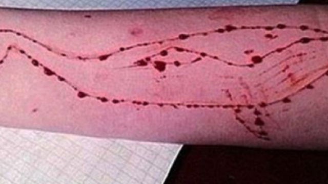 Blue Whale: salvato un diciassettenne dal suicidio a Messina - sportfair.it