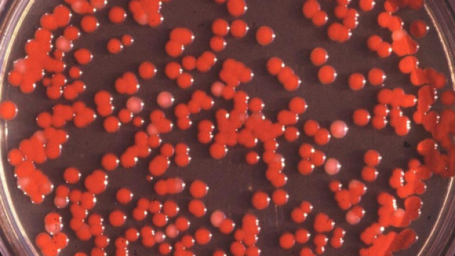 Una coltura di Serratia marcescens.