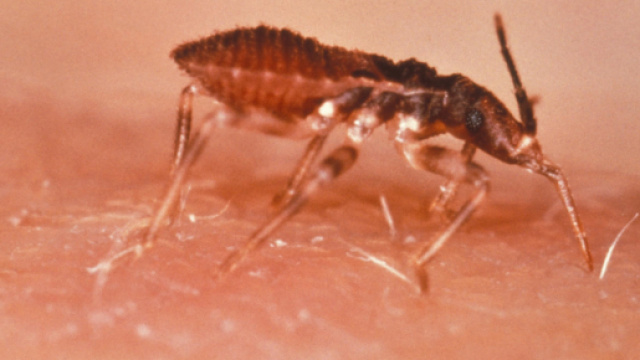 Malattia di Chagas - Wikipedia - wikipedia.org