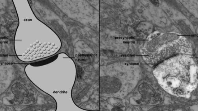 Una sinapsi vista al microscopio elettronico e poi schematizzata (https://www.pinterest.it/pin/565905509397169353/)