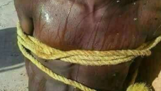 Una delle immagini che raccontano le violenze subite dai migranti in Libia