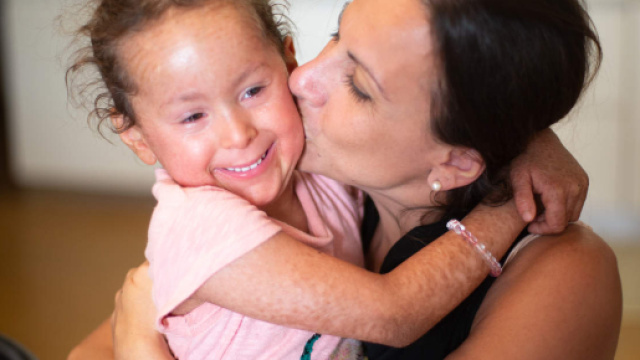 Bambina pesciolina, affetta da ittiosi lamellare