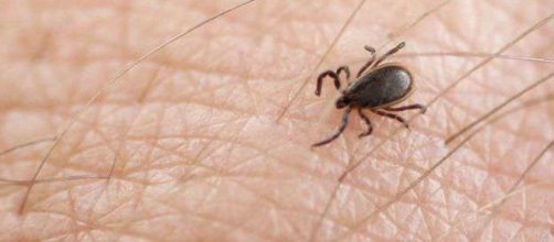 Un hombre de 74 a&ntilde;os muere luego de ser picado por una garrapata