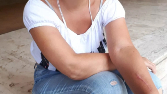 "Cos&igrave; mi hanno rotto le ossa". il racconto di una delle vittime della banda delle truffe alle assicurazioni