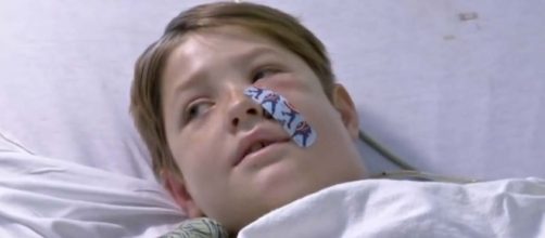 Xavier Cunningham miraculously survived falling from a tree onto a meat skewer. [Image Associated Press/YouTube]