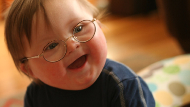 Stati Uniti: coniugi adottano bimbo con sindrome di Down come la loro prima figlia - coordown.it