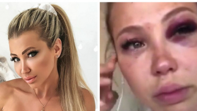 Les Vacances des Anges 3 : Andr&eacute;ane continue de balancer sur R&eacute;mi apr&egrave;s leur accident