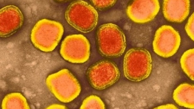 Vaiolo delle scimmie (Monkeypox)