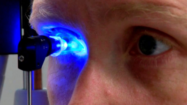 Scozia, pomata contro la disfunzione erettile consegnata per curare sindrome dell'occhio secco.