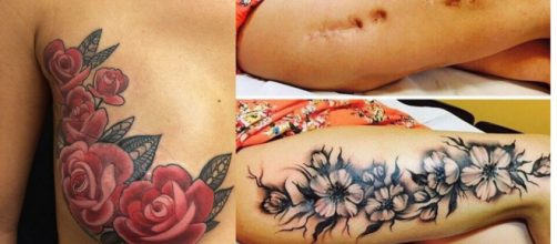 Cicatrizes que ganharam vida nova com tatuagem. (Foto/Reprodu&ccedil;&atilde;o via Virgula.com)