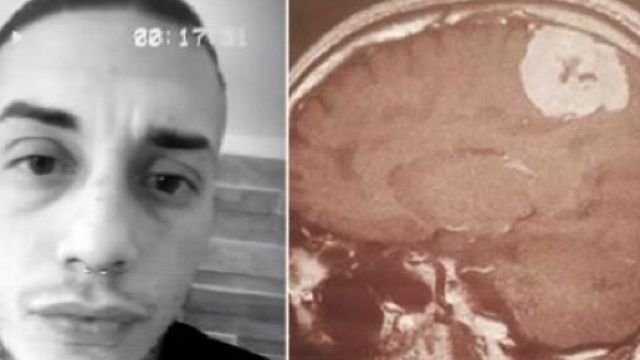 Francesco Chiofalo, parla la madre: 'Non si sa se il tumore &egrave; benigno o no'.