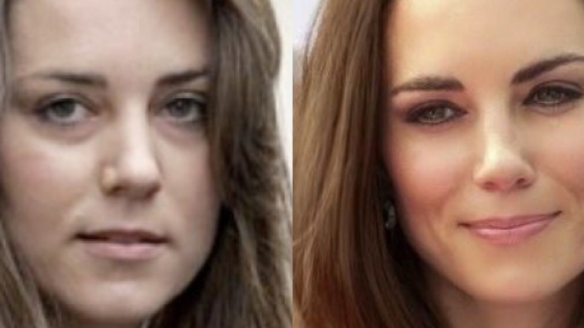 Naso Kate Middleton stile diverso