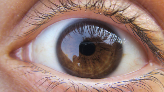 Regno Unito, ragazza 19enne va ad una visita oculistica e scopre di avere un male incurabile allo stato terminale