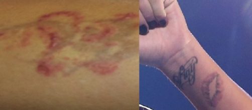 At&eacute; mesmo as celebridades se arrependem de fazer tatuagem. (Foto/Reprodu&ccedil;&atilde;o via Uol).