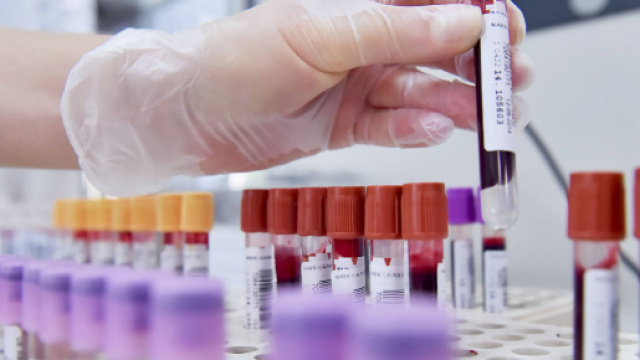 Sassari: giovane 23enne muore a causa di una rara forma di meningite