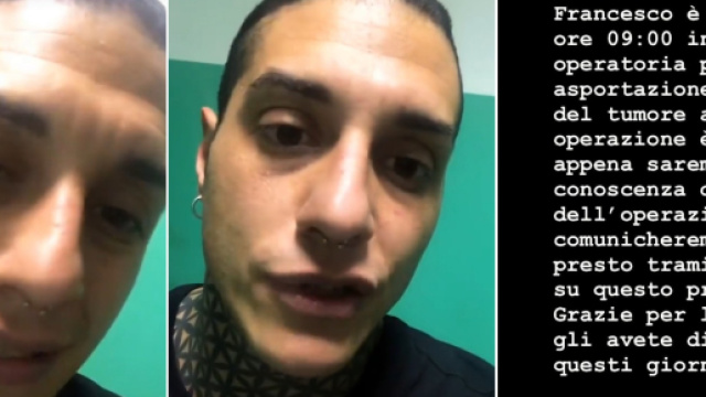 Francesco Chiofalo informa i fan sul decorso post-operatorio