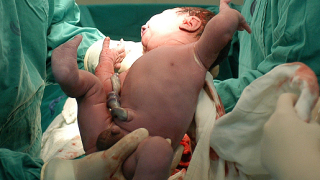 parto &ndash; S.I.S.Me.R &ndash; Centro di fecondazione assistita-sismer.it - sismer.it