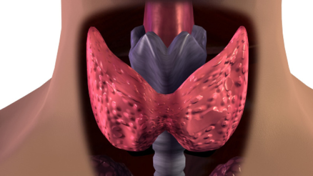 Tumore alla tiroide: i fattori di rischio.