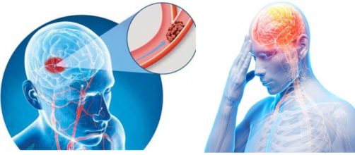 Esses sinais devem ser acompanhados atentamente. (Foto/Reprodu&ccedil;&atilde;o)