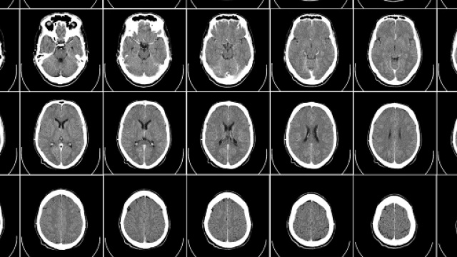 grandi polemiche sulla vicenda di Lenticchio