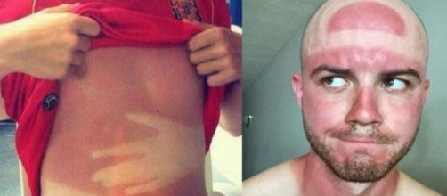 O sol &eacute; um aliado para tatuagens naturais. (Foto/Reprodu&ccedil;&atilde;o via Criatives).