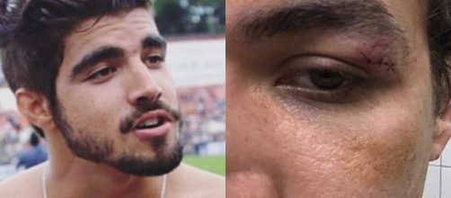 Caio Castro e o rapaz agredido (Foto - Reprodu&ccedil;&atilde;o)