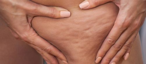 Fuja dos mitos sobre a celulite | via BOA FORMA