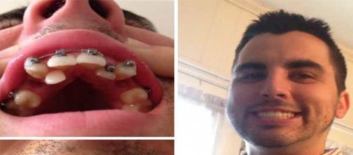 Mudan&ccedil;a no sorriso. (Foto/montagem:ncuriosidades.org)