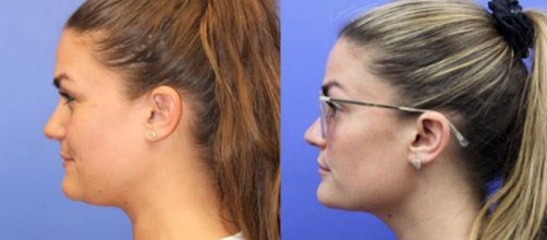 Brittany Cartwright shows off new neck. [Photo via PlastixDocs/Instagram]