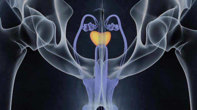 Cancro ai testicoli: alcuni campanelli d'allarme